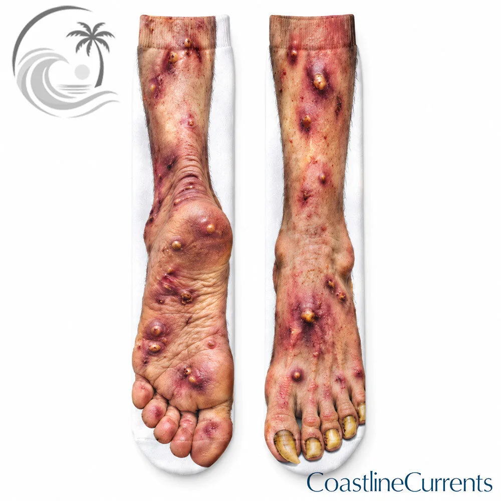 Gross Blistered Feet Horror Prank Gift Mid Tube Socks | Apparel – image 2 of 2